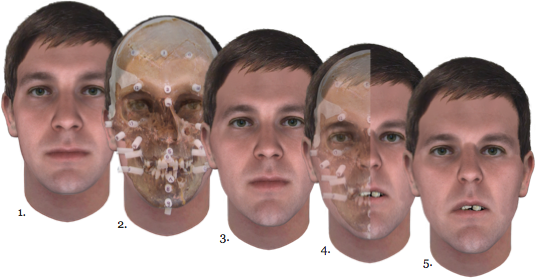 Reconstruction Process